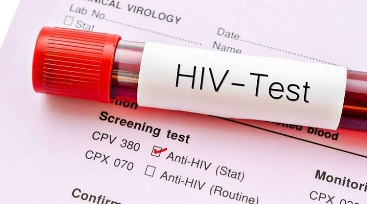 7-signs-that-you-may-have-hiv